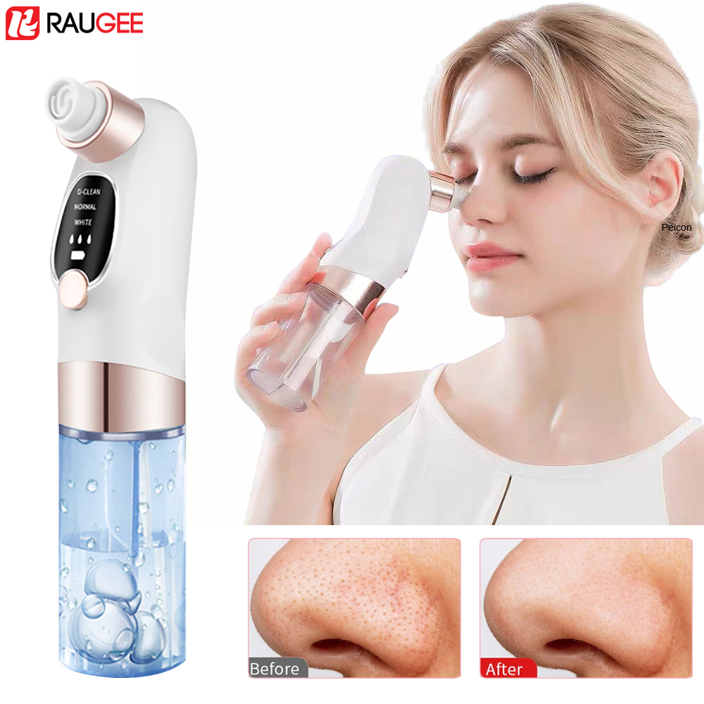 Extracteur de points noirs éle - Nasal Aspirator avis et prix
