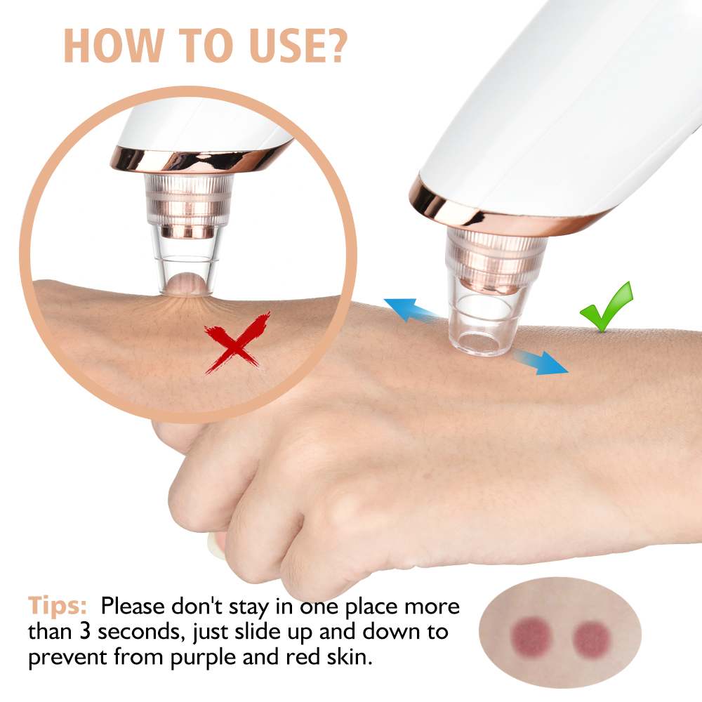 Aspirateur de points noirs, ne - Nasal Aspirator avis et prix